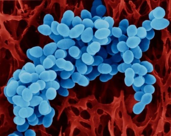 The action of Chitosan (in blue) against the cell membrane of bacteria