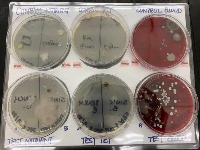 Bologna Bacteria Sample Results.