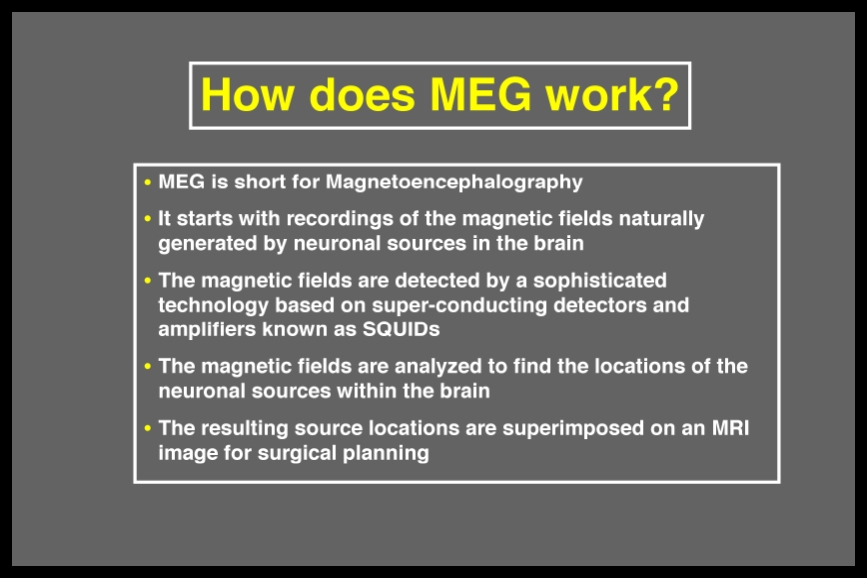 Basic principles of Magnetoencephalography