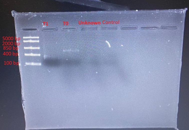 Gel electrophoresis of PCR products. The PCR products were digested with PvuII by incubating at 37oC. Lane 1 shows distinct molecular ladder bands, whereas lanes 2 and 3 show very faint bands. Lanes 4 and 5 do not have any bands of DNA.