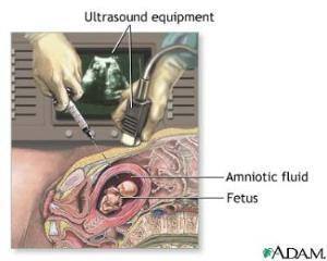 Developing fetus in the uterus