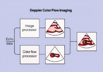 Colour Flow Doppler