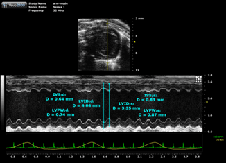 Is an example of m-mode imaging showing the left ventricle
