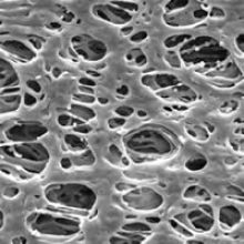 Microscopic view of polyethersulphone