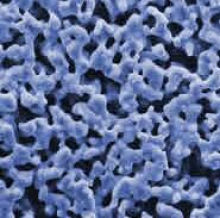 Microscopic image of a silver membrane.