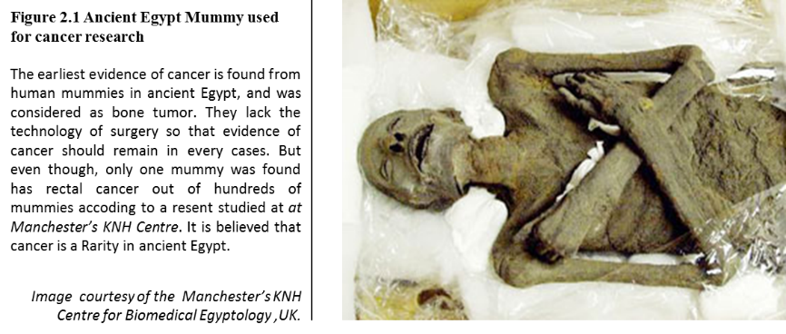 Ancient Egypt Mummy used for cancer research