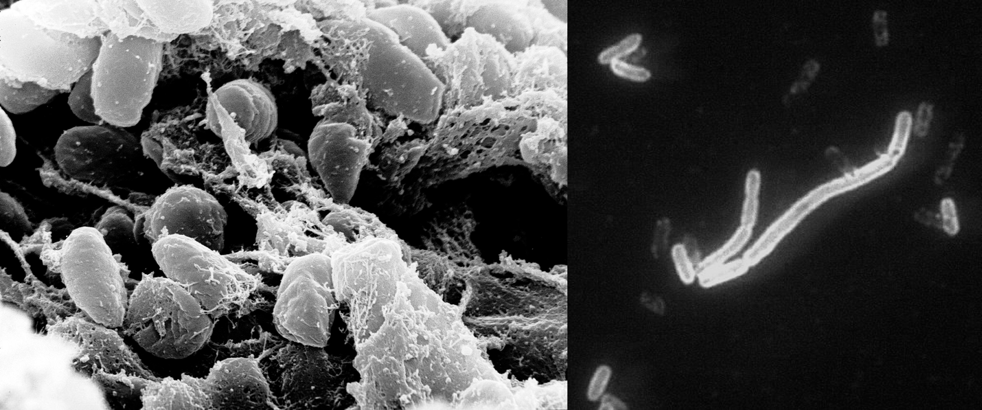 Microphotograph of the morphological structure of Yersinia pestis