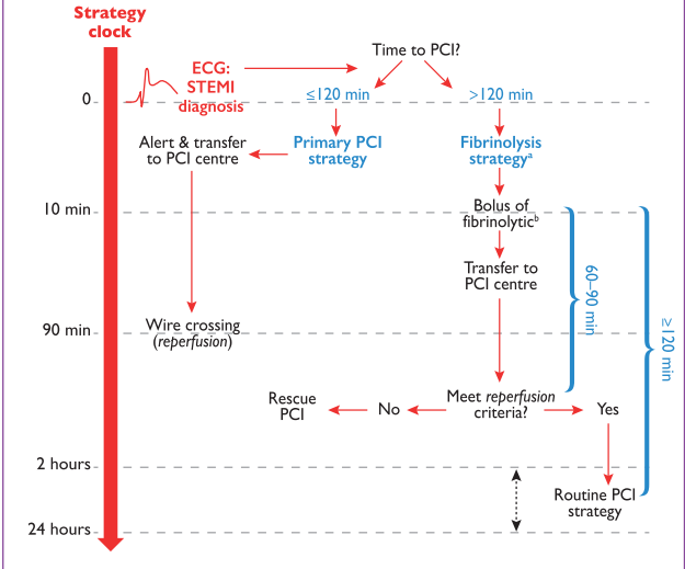 Timeline on treatment for STEMI