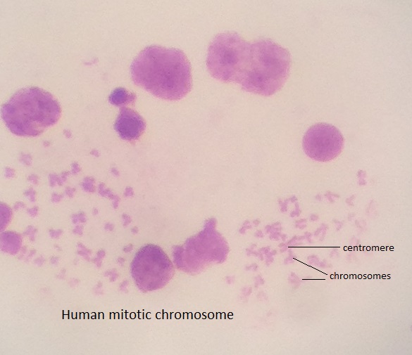 Mitotic chromosomes in human cells