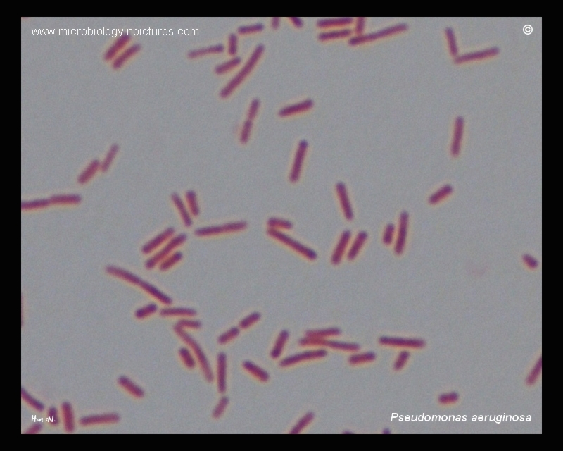 Microscopic photograph of the sample showed a bacilliform morphology 