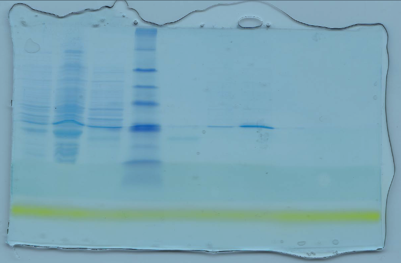 Showing a 15% SDS-PAGE gel. (A 15% SDS Page gel running of loaded samples and a protein marker). (Reed, Holmes, Weyers, & Jones, 2007)