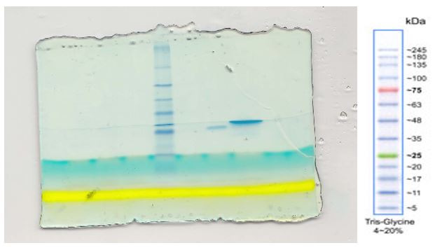 15% SDS-PAGE gel with loaded samples and a protein marker. (Reed, Holmes, Weyers, & Jones, 2007)
