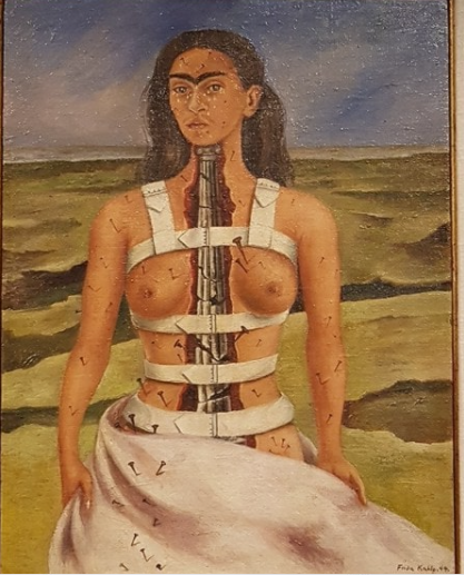 The Broken Column by Frida Kahlo In Context Picture