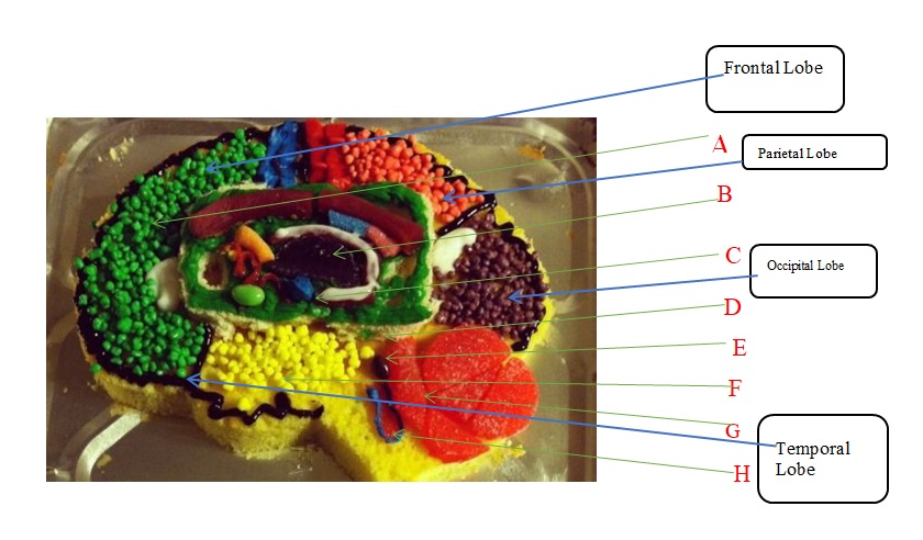 The constructed model of the brain.