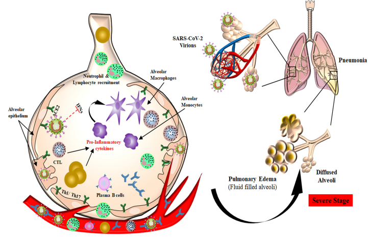 Various host reactions to the COVID-19 infection