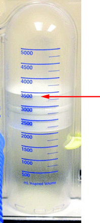 Inspiratory volume measurement