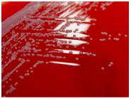 Blood Agar Test Results