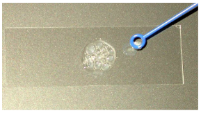Catalase Test Results