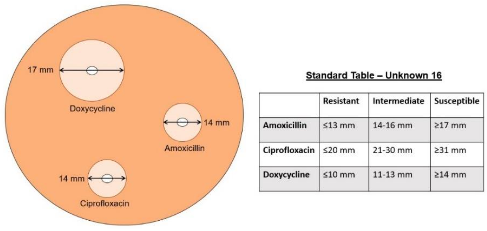 Kirby-Bauer Test Results