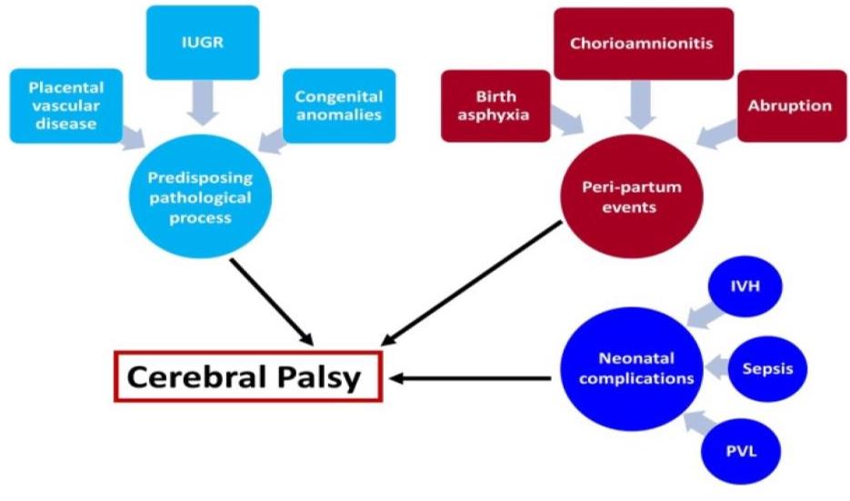 Causes of Cerebral Palsy