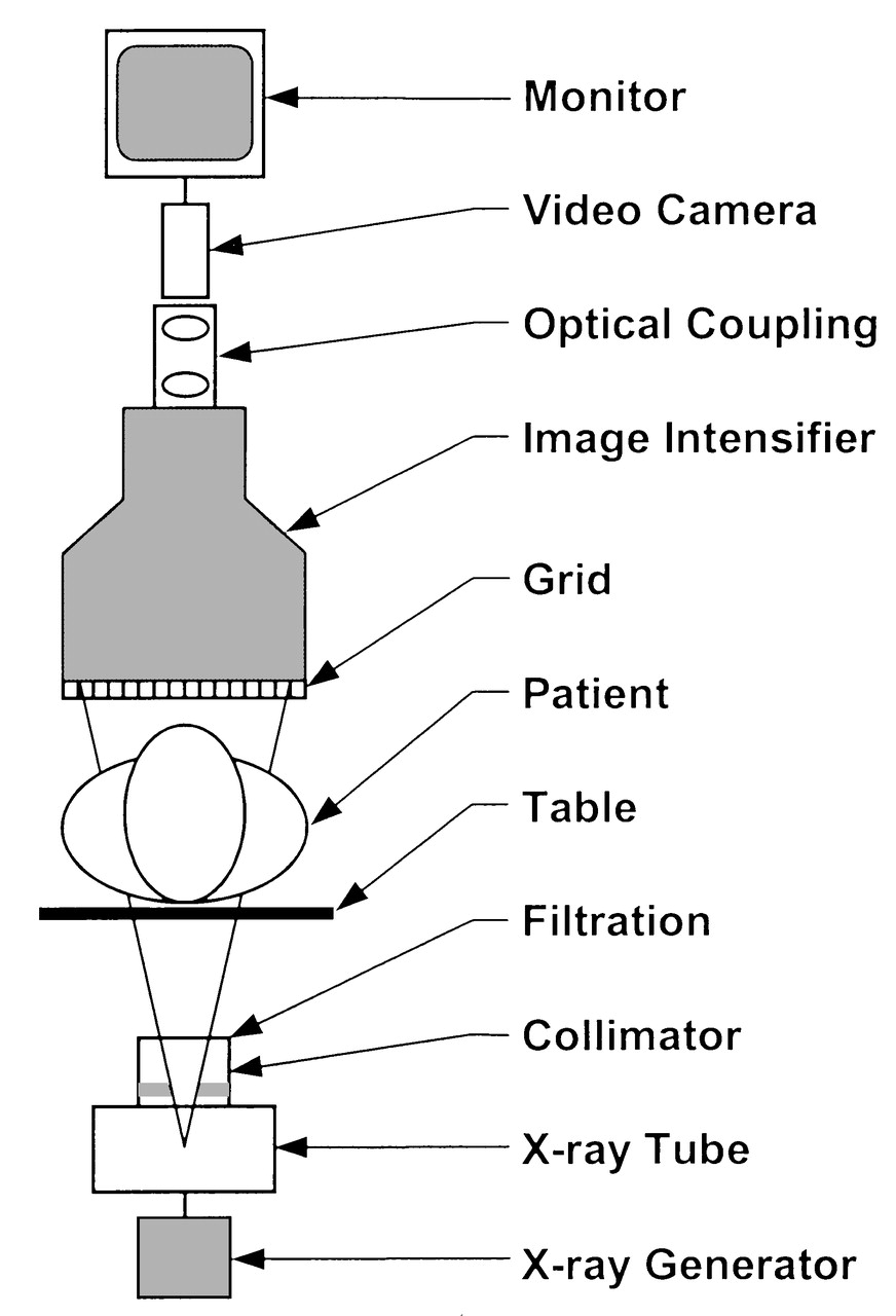 A fluoroscopic system schematic diagram with an X-ray image intensifier and video camera.