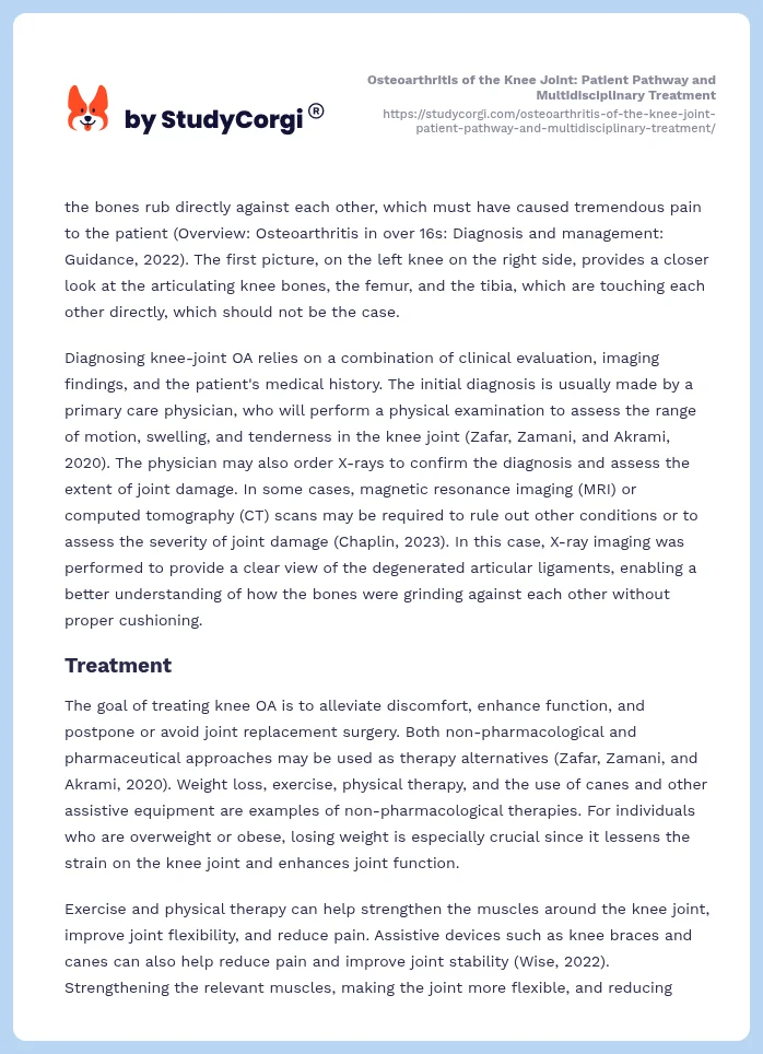 Osteoarthritis of the Knee Joint: Patient Pathway and Multidisciplinary Treatment. Page 2